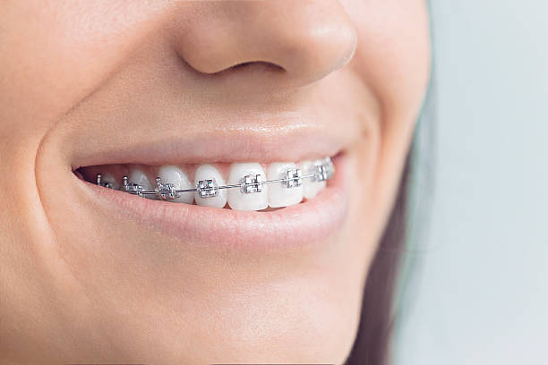 Best Invisalign and Clear Aligners  in Russellville, AR
